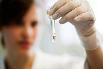 UKE erhält neuen Sonderforschungsbereich 