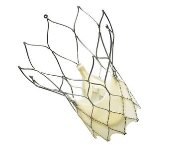 G-BA prüft TAVI-Erweiterung