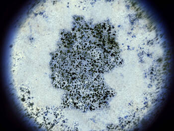 Kritik an MRSA-Screening