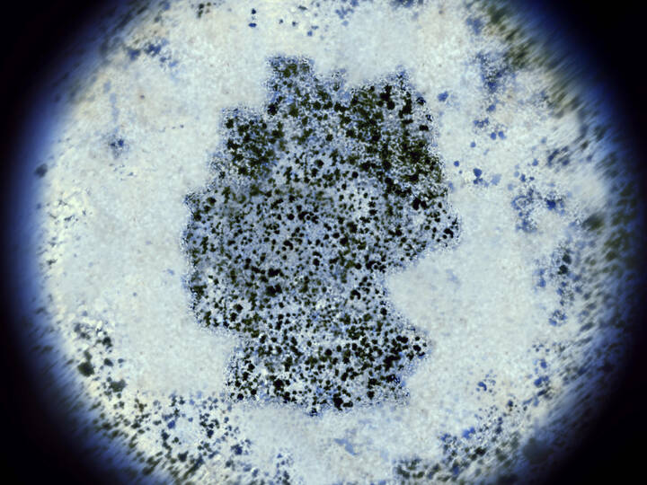 Kritik an MRSA-Screening