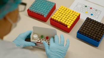 Covid-Antigen-Schnelltest von Siemens Heathineers