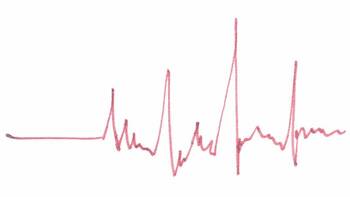 Kardiologie der Zukunft: Primärprävention gehört vergütet
