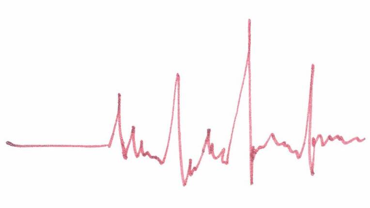 Kardiologie der Zukunft: Primärprävention gehört vergütet