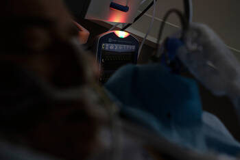 Leistungseinschränkungen drohen