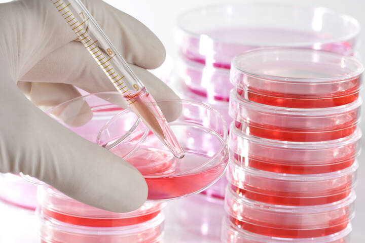 Wissenschaftler entwickeln KI-basierten Krebstest