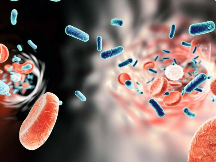 NRW fördert Forschungsprojekt für KI-gesteuerte Sepsis-Therapie